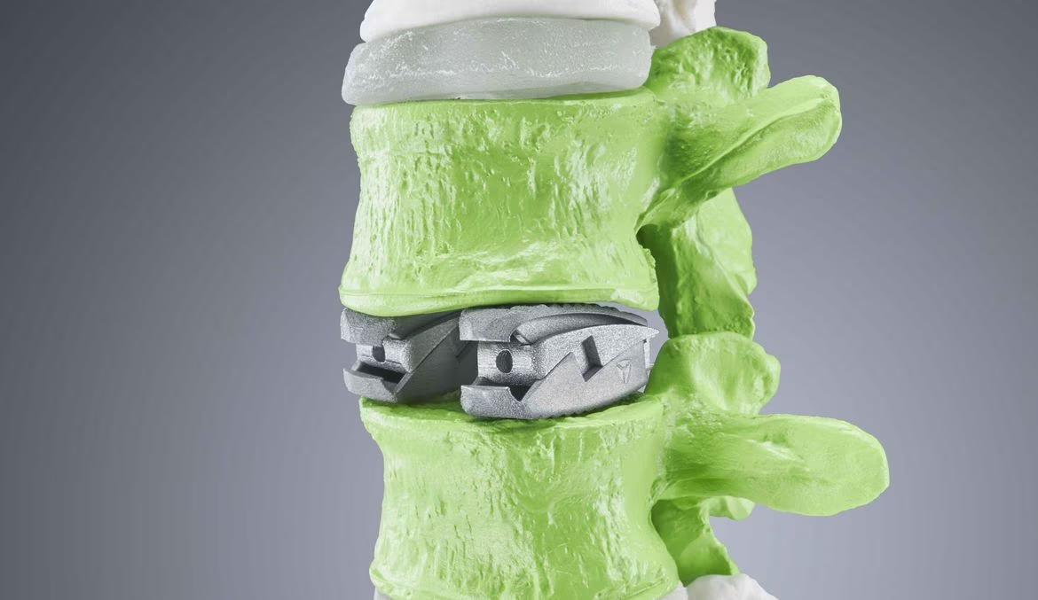 Dispositivo Medico 3D